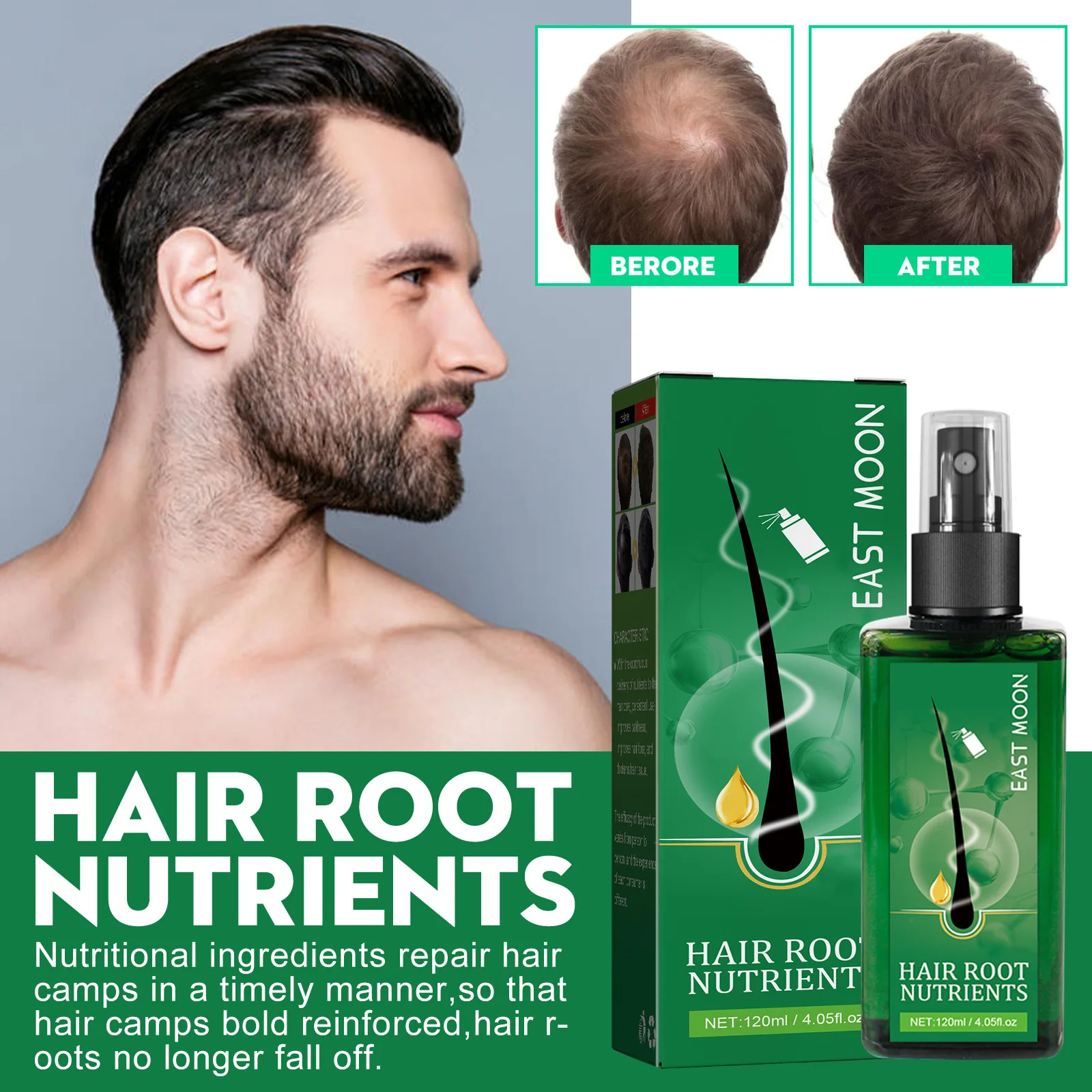 Neo Hair Lotion Natural Hair Care Vanilla Spray Anti Hair Loss Neutral Hair Growth Lotion Hair Regeneration Essence 120ml