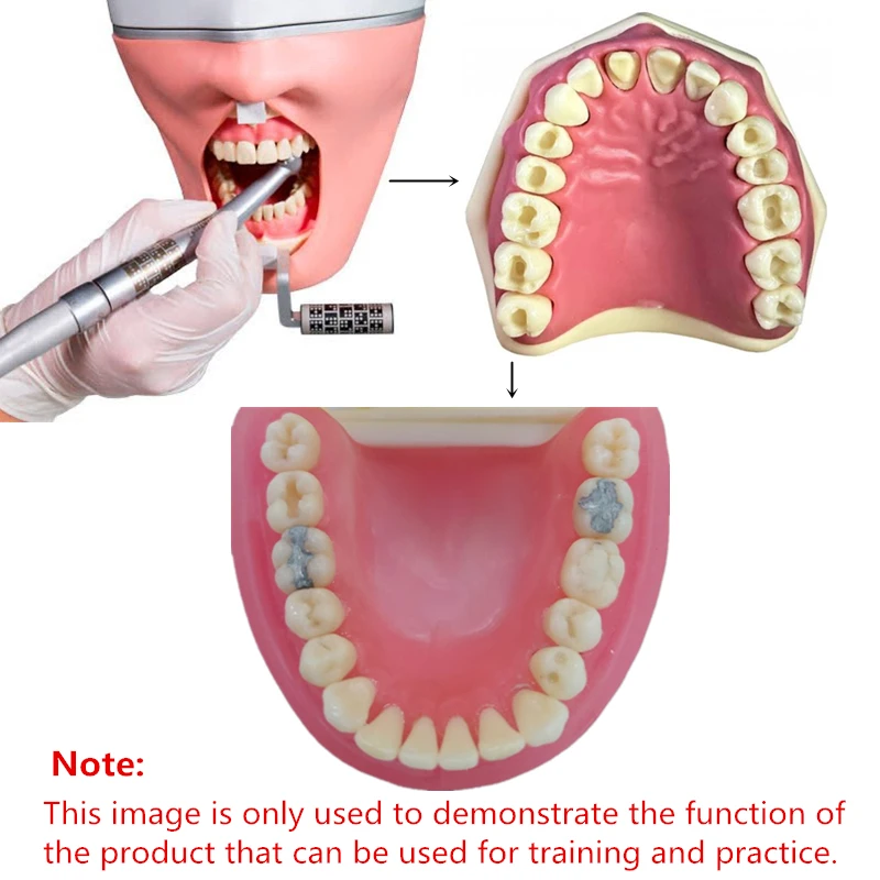 1 шт., стоматологическая тренировочная модель, модель зубов для зубных техников, практика для NISSIN D16FE-500H(GSF)-модель MF, резиновые аксессуары для...