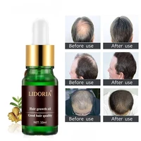hair growth essential oil hair restorer prevent hair loss treatment fast grow hair repair pilatory promote hair growth regrowth
