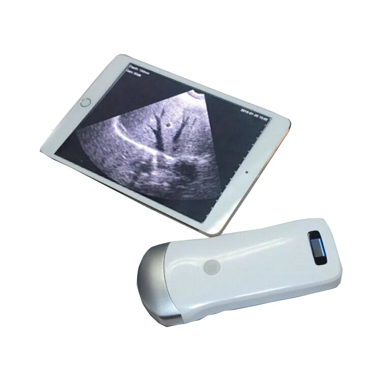 

Low Price Mini Laptop New Full Digital Portable Ultrasound Machine/Ultrasonic Scanner/Echo Machine