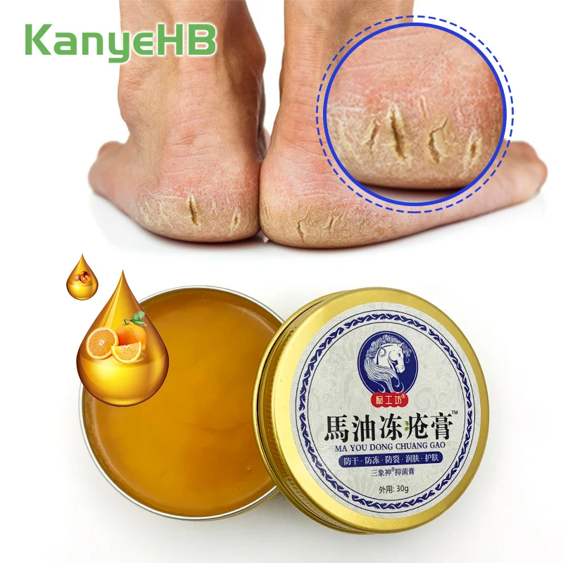 

1pcs Heel Anti Chapped Cream Chapped Heel Pain Relief Cream Horse Oil Moisturize Cream Hand Foot Skin Care Essential Oils S048