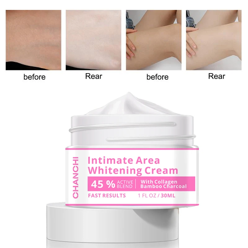 30ml Whitening Cream 7 Days Underarm Skin Whitening Bleaching Cream Underarm Dark Skin Whitening Body Lotion Free Shipping