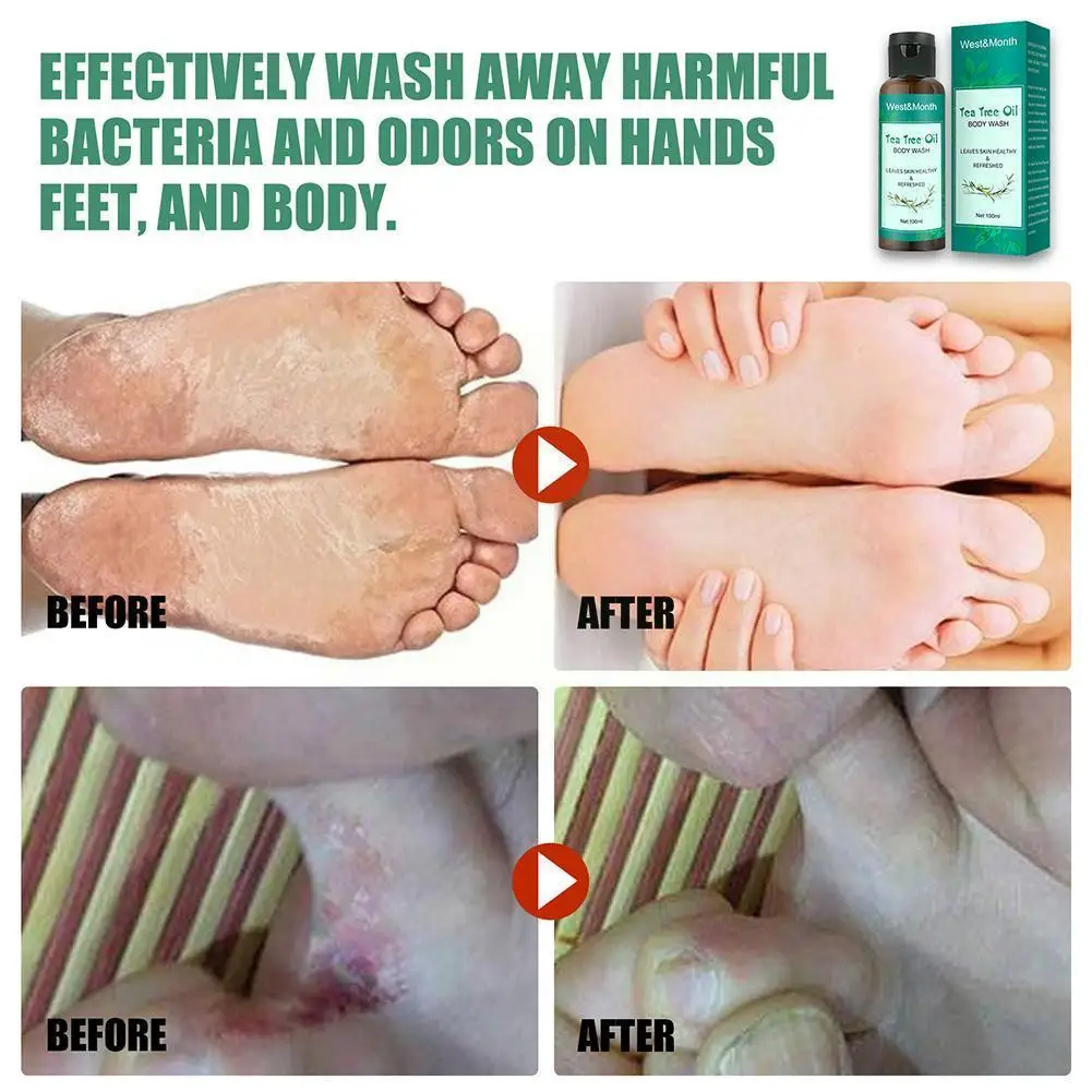 

Tea Tree Oil Shower Gel Body Wash Antifungal Soap100ml Skin Moisturizing Refreshing Shower Body Gel Care Perfumed Cleansing W6y2