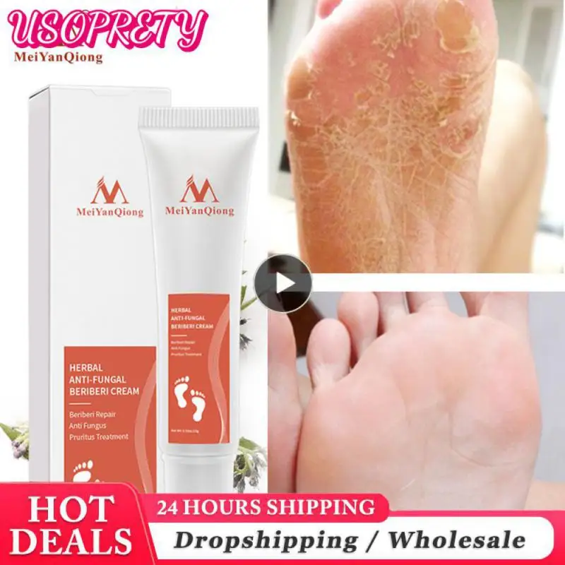 

Heel Repair Cream Anti Crack Whitening Foot Peeling Cracked Hands Feet Dry Skin Moisturizing Care repair relieves skin disorders