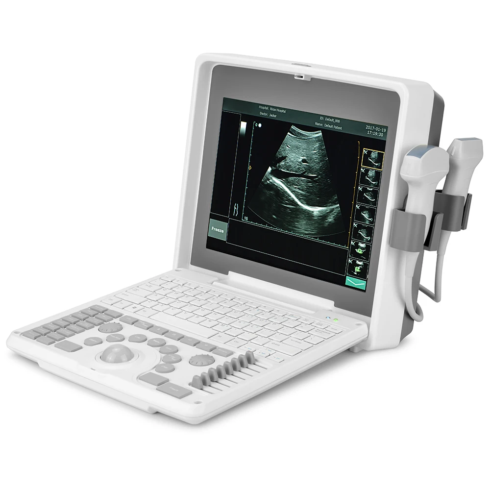 

Laptop Handheld Veterinary Color Doppler Ultrasound veterinary ultrasound machine