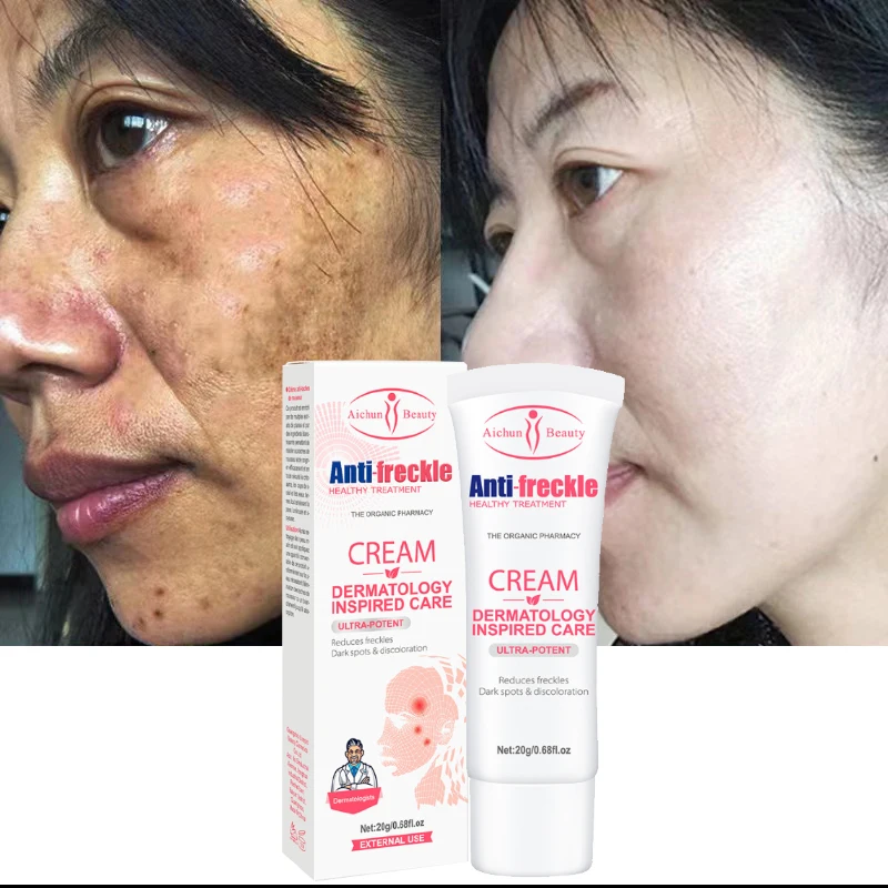 

Effective Whitening Freckles Cream Nicotinamide Moisturizing Repair Smoothing Anti-Aging Oil Control Lifting Firming Face Care