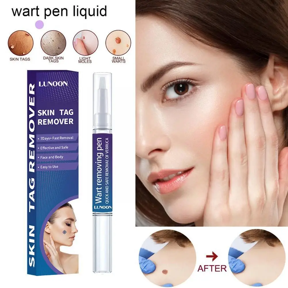 

7Days Painless Skin Tags Remover Serum Herbal Warts Remedy Mole Freckle Essential Oil Spot Treatment Removal Acne Pen Liqui E5H4