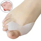 Ортопедические скобы для большого пальца ноги, при вальгусной деформации