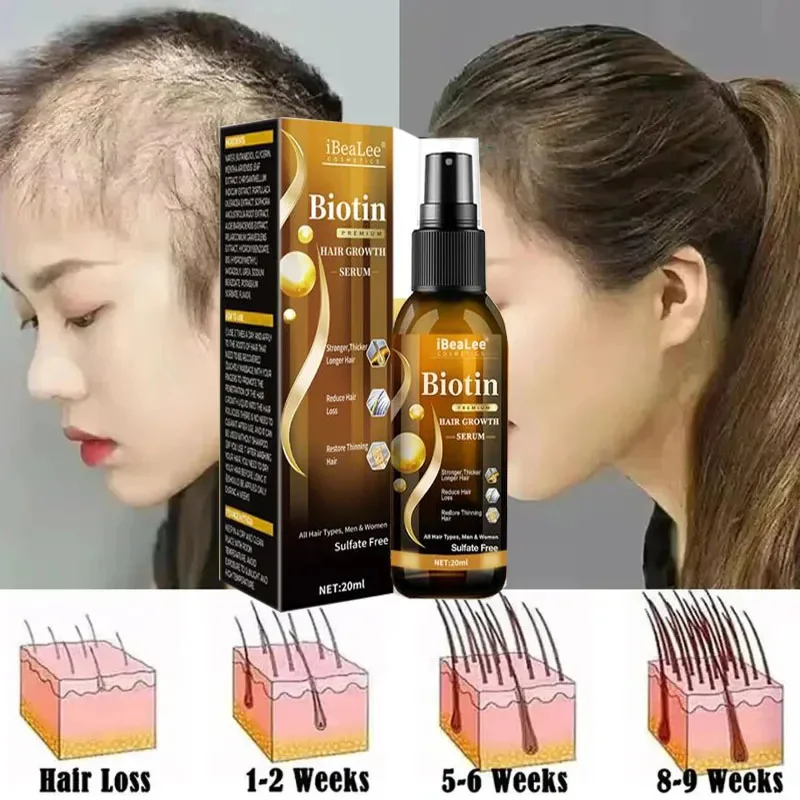 Продукты для роста волос биотин спрей против выпадения лечение кожи головы