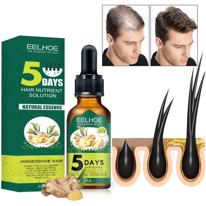 

5 Days Ginger Hair Growth Essential Oil Products Anti Hair Loss Serum Fast Growing Nourish Soften Scalp Repair Damaged Hair Care