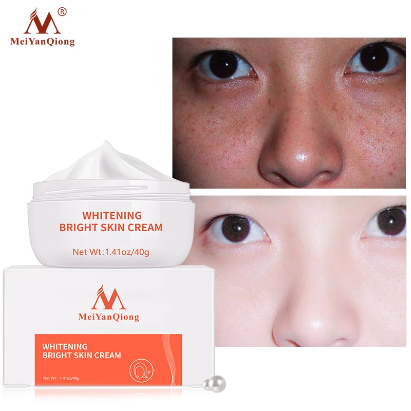 

MeiYanQiong Whitening Freckle Cream Remove Acne Spots Melanin Dark Spots Face Lift Firming Face Skin Care Beauty Essentials