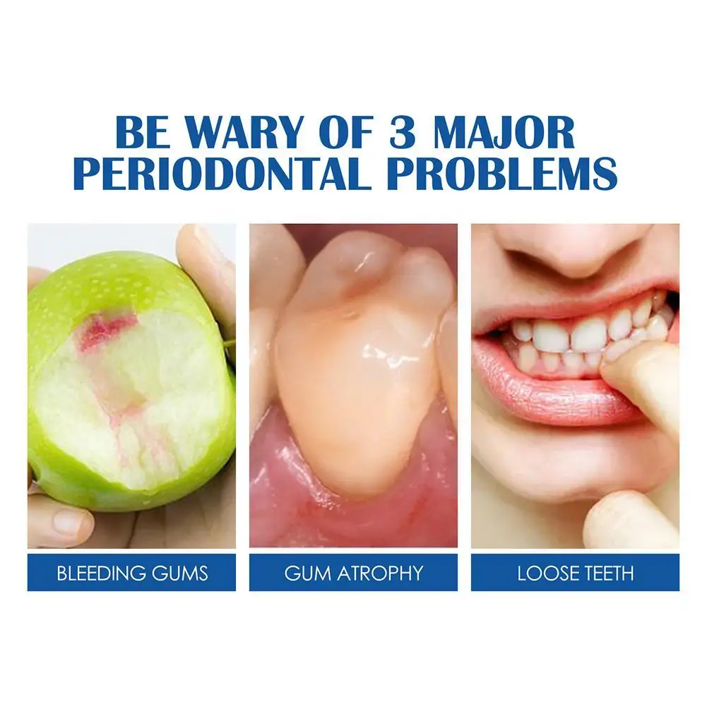 Рисунок 3 - Зубная паста для отбеливания зубов