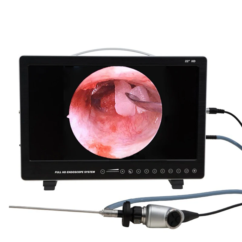 

Endoscope camera portable endoscopy camera Imaging system compatible with both rigid and flexible endoscopes