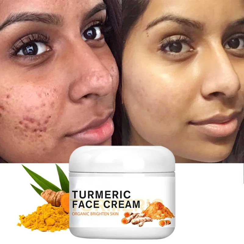 

Turmeric Face Whitening Cream for Dark Skin Remove Acne Lighten Dark Spots Moisturizing Brightening Cream for Face Skin Care