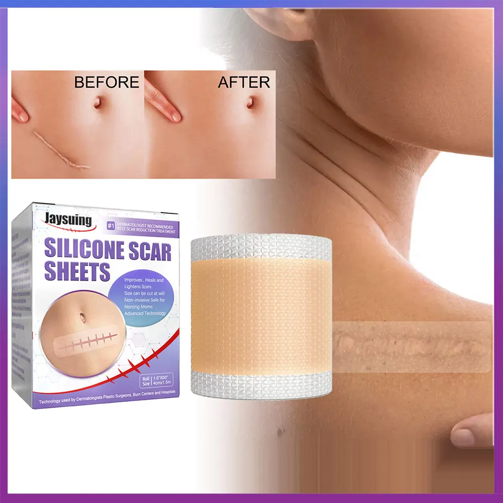 

Самоклеящаяся силиконовая паста для рубцов, ремонт и улучшение хирургии, лакларотомия, ожоги, натуральная долговечная невидимая косметиче...