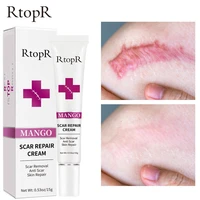 mango trace removal cream effectively restores marks left by wounds and burns high nutrition accelerates collagen production