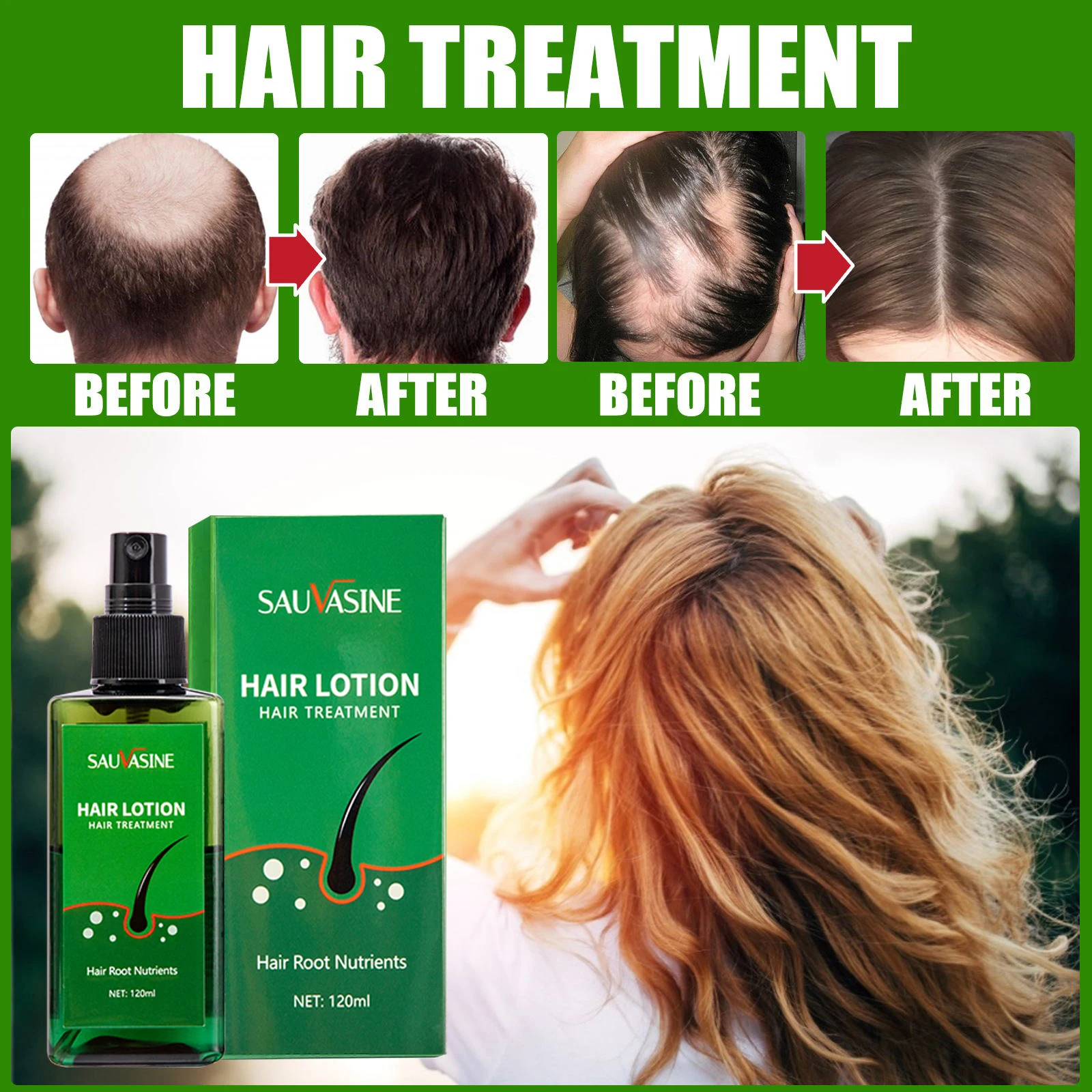 

Micro Needle Roller Grow Hair Serum Anti Loss Oils Regrowth Vitamins Treatment Hair Growth Oil Spray Thailand New Hair Lotion
