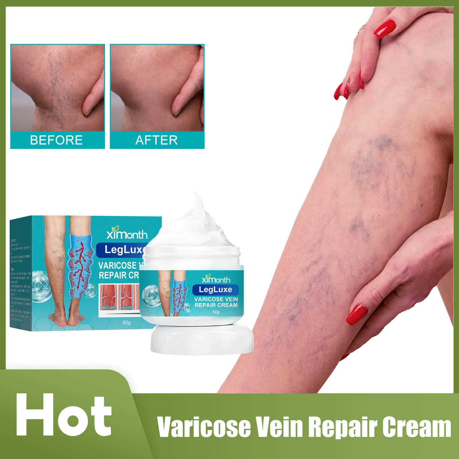 

Varicose Vein Repair Cream Effective Relieve Bulge Pain Remove Earthworm Legs Vasculitis Phlebitis Treatment Venous Ointment 60g