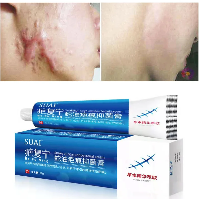 

Acne Surgical Scar Removal Cream Pimples Stretch Marks Face Gel Acne Smoothening Whitening No Stimulation Body Skin Care