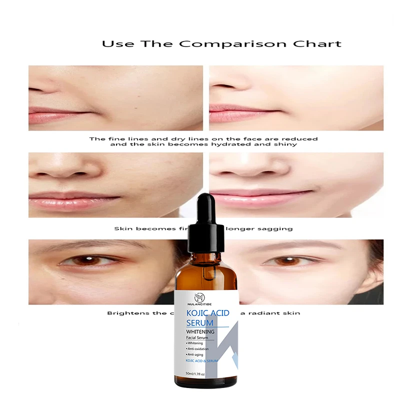 

Kojic Acid Collagen Face Essence Shrinks Pores Freckle Serum Anti-oxidation Whitening Moisturizing Pimple Remover Facial Care