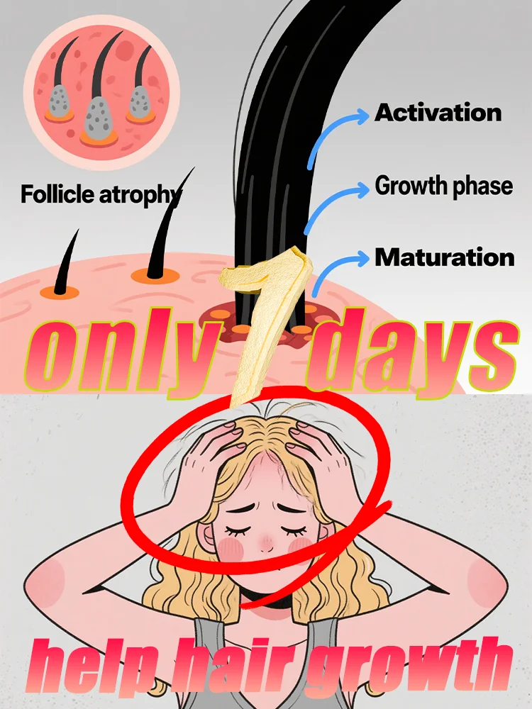 

Имбирный спрей для роста волос