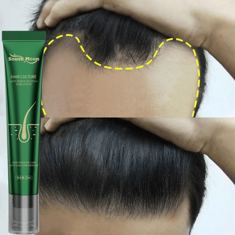 

2023 Fast Hair Growth Oil Anti-Hair Loss Roller Massage Regrowth Serum Hair Thinning Treatment Repair Hair Roots for Women Men