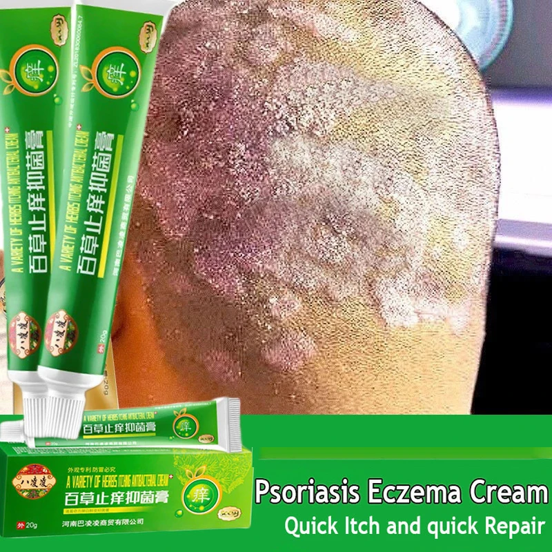 

Relieve Itching Fast Antibacterial Cream Psoriasis Ointment Herbal Treatment Fungus Eczema Anti-itch Rash Urticaria Desquamation