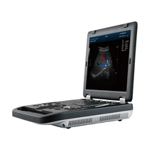 good quality portable doppler laptop color hy m10 pw ultrasound scanner