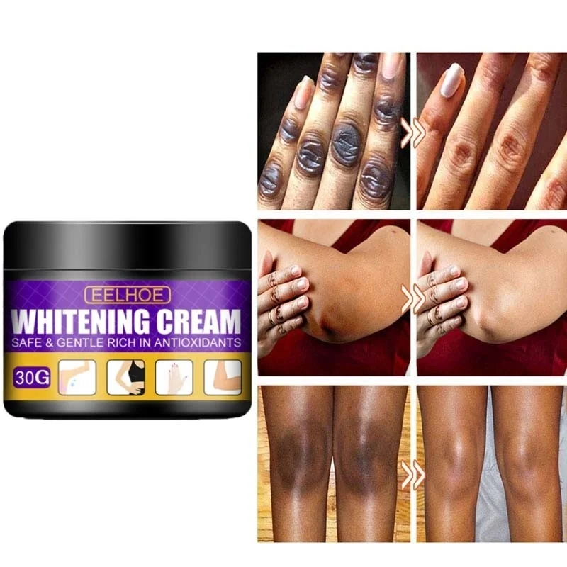 

Body Whitening Cream Remove Underarm Buttocks Private Knee Melanin Beauty Products Moisturizing Brightening Nourishing Skin Care
