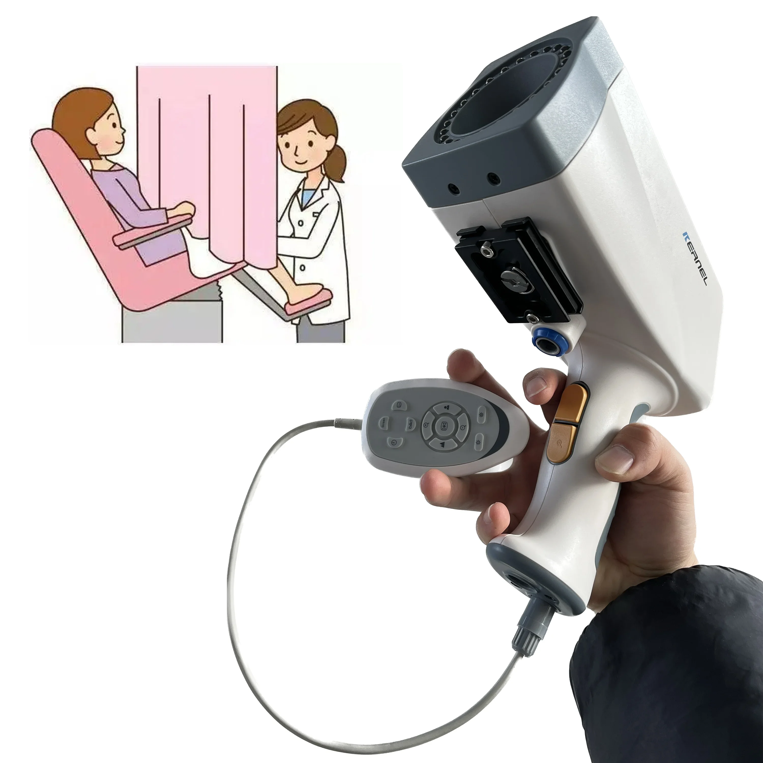 Карманная камера-эндоскоп для гинекологических целей