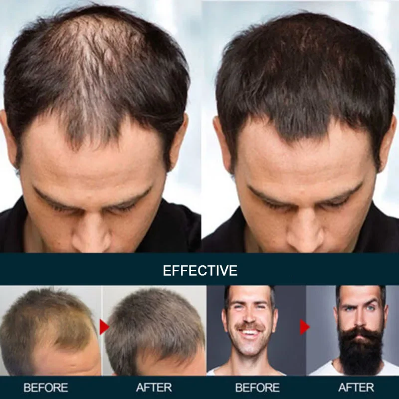 Спрей для роста волос 100 мл натуральный имбирь предотвращает выпадение и