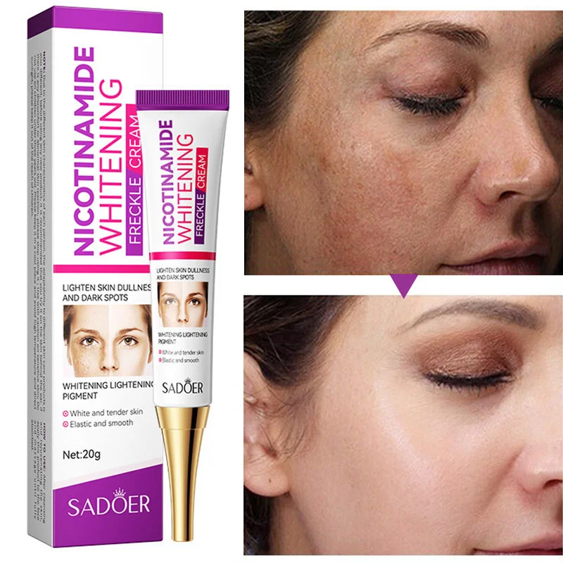 Freckle Cream Dark Spot Removal Whitening Cream Reduce Sun Spots Acne Marks Melanin Melasma Pigmentation Blemish Face Skin Care