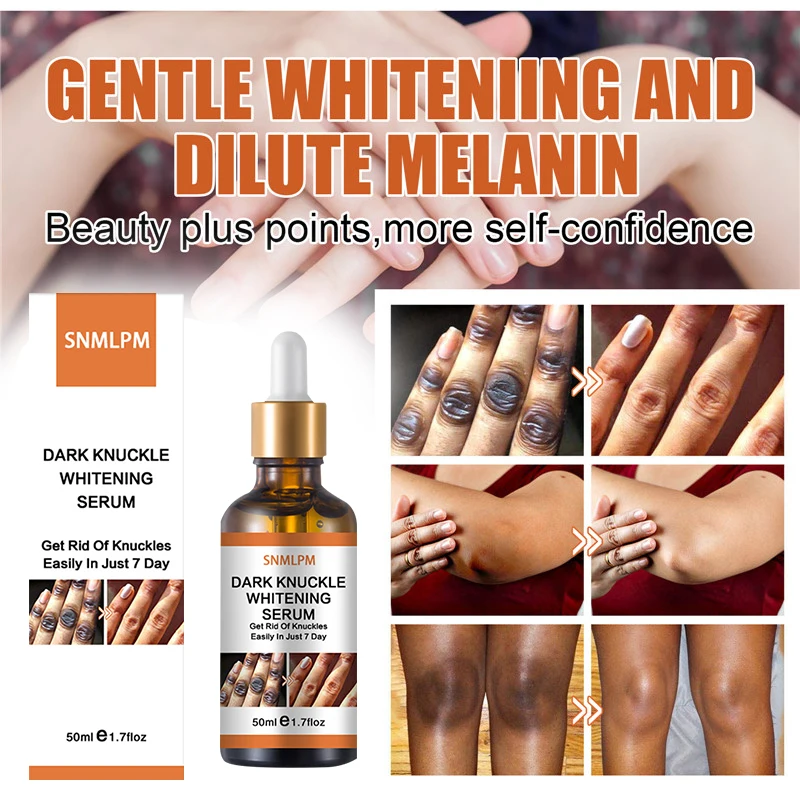 

50ml Dark Knuckles Whitening Serum Elbow Armpit Knee Ankle Brightening Essence Lighten Melanin Dark Knuckle Remover