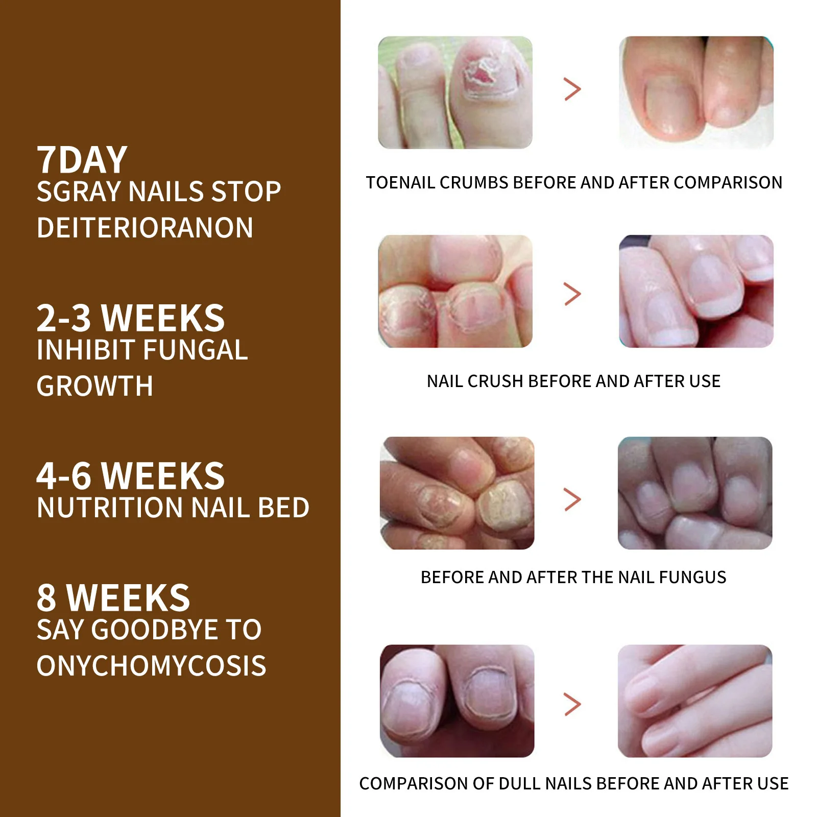 Органическая сыворотка для роста ногтей восстанавливающая ногти рук и ног рот на