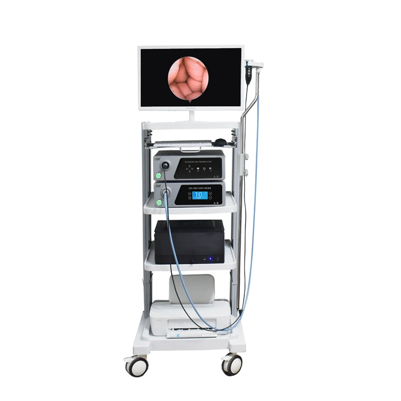 

Hospital Equipment Endoscope System for Laparoscope