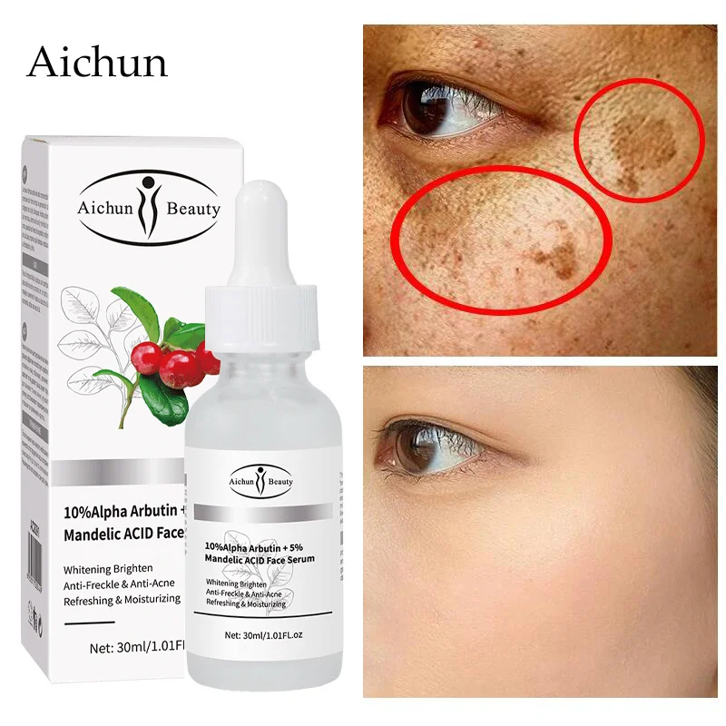 

Whitening Freckle Serum Fade Dark Spots Remove Melanin Melasma Cream Brighten Anti-Aging Skin Care Whiten Products Shrink Pores