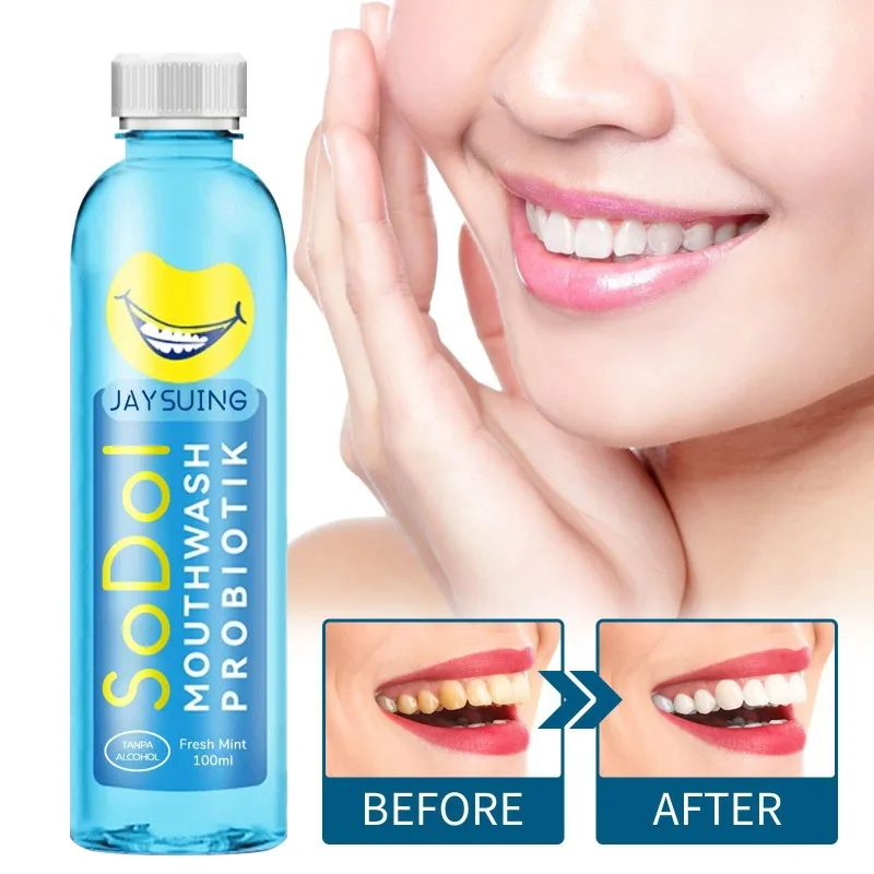 

Mouthwash remove tooth stains odor clean Yellow tartar Whitening teeth Lasting fresh breath Mouth Toothpaste Oral Smell Care