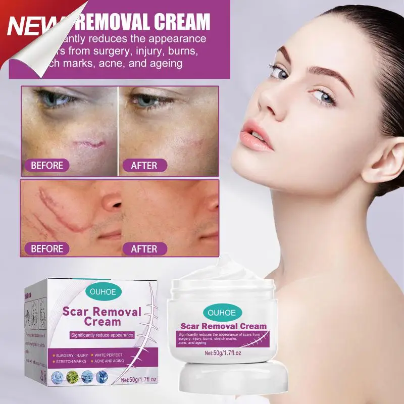 

Making The Skin Smooth Scar Repair Cream Very Gentle And Non Irritating To The Skin Scar Removal No Stimulation Very Gentle