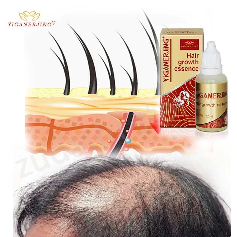 

3Pcs YIGANERJING Hair Growth Agent Products Anti Hair Loss Natural Organic Oil for Fast Hair Growth Vitamins Serum 20ml