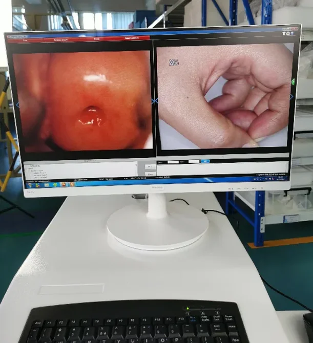 Ручной кольпоскоп ccd SD Digital Colposcope kn-2200 для гинекологии осмотра влагалища