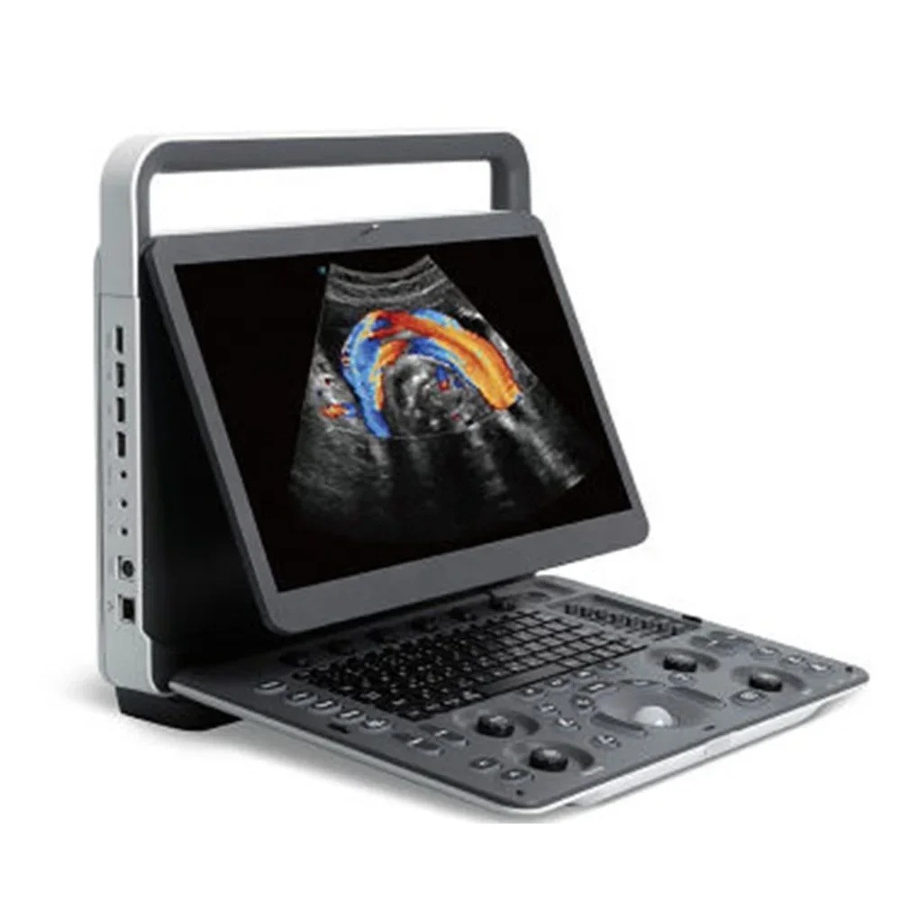 Рисунок 6 - Sonoscape E2V, большая портативная