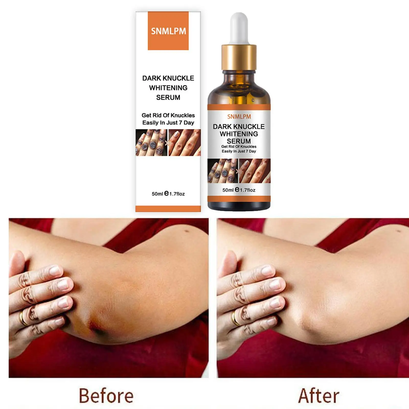 

Joint De-blackening Beauty Serum Dark Knuckles Knee Ankle Corner Armpit Whitening Lighten Melanin Bleaching Skin Care Products