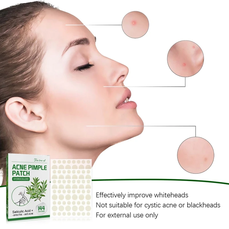 144 шт. гидроколлоидная салициловая кислота для лечения прыщей и акне