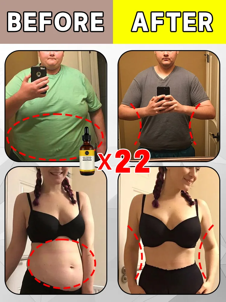 Необходим для сжигания жира талии живота антицеллюлита продуктов похудения