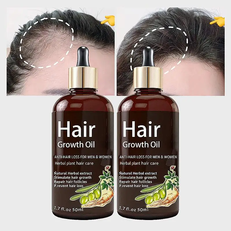

Biotin hair care serum promotes hair growthserum hair care essencehair growth oil