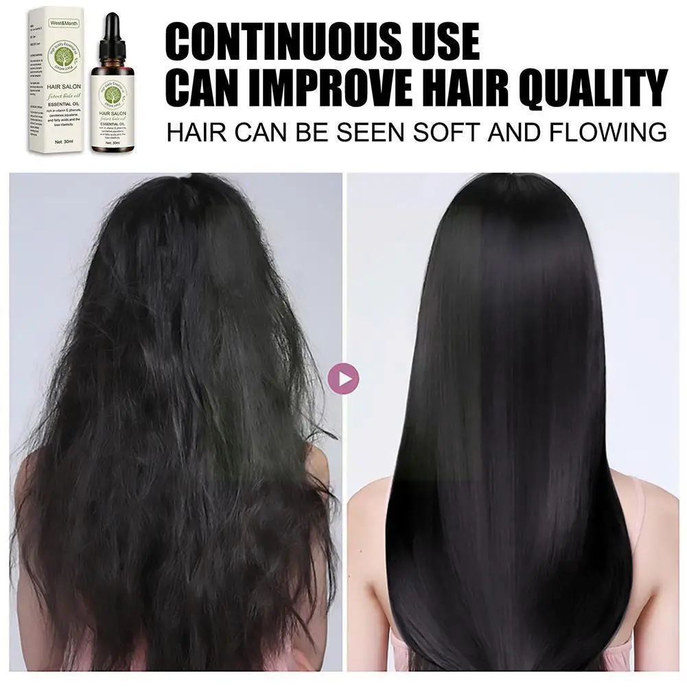 

Hair Growth Essential Oils Essence Prevent Thinning Oil Hair Hair Perfect 30ml Essential Droshipping Hair Regrowth Serum R3e5