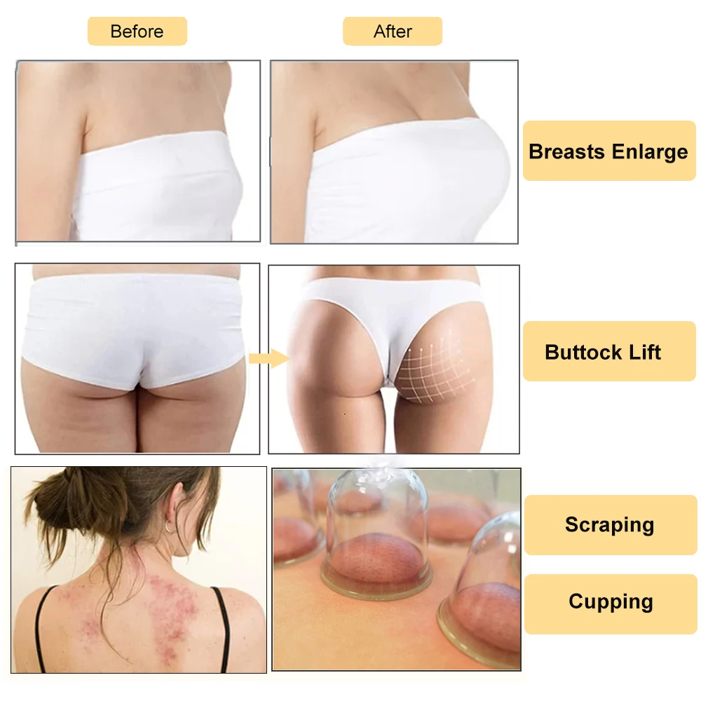 Вакуумный массажер для увеличения груди ягодиц и подтяжки |