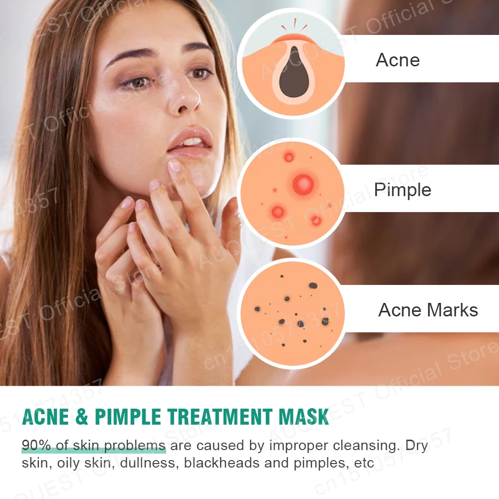 Глиняная маска Черные точки Удаление черных точек Маска для лица Глубокое