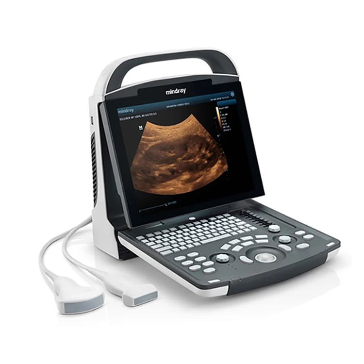 

Ultrasound Scanner High Frequency Portable Ultrasound Machine Conversion Notebook Ultrasound Scanner