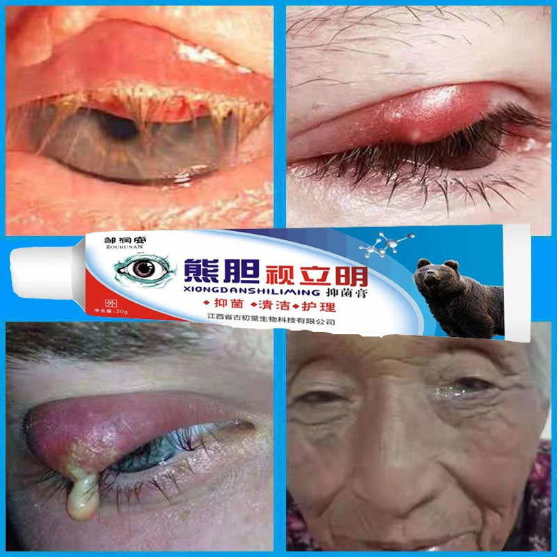 

20g Herbal Eye Cream to Improve Vision, Myopia, Tear Eyes, Relieve Eye Fatigue, Dry Ointment, Remove Red Blood, Medical Plaster